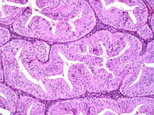 Endometrial histology — glandular tissue