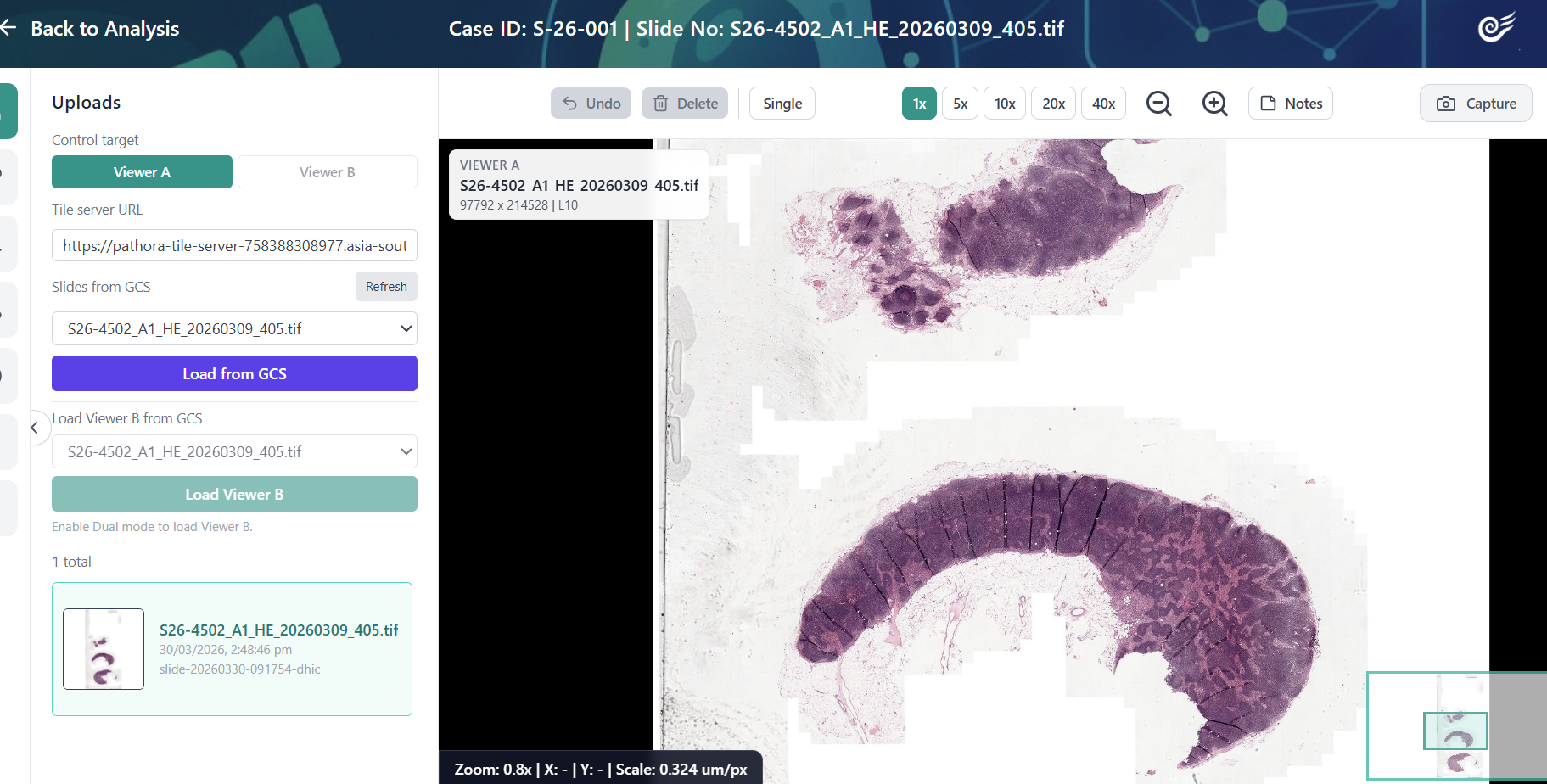 Pathora AI Pathology Assistant interface